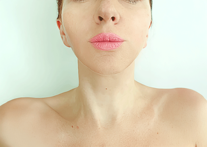 After treatment 1