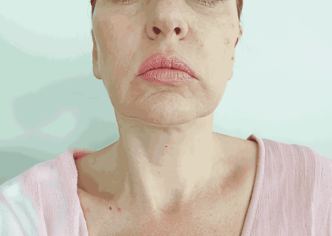 Before treatment 1