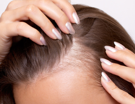 know-more-about-Oxygen Scalp-treatment-in-Delhi