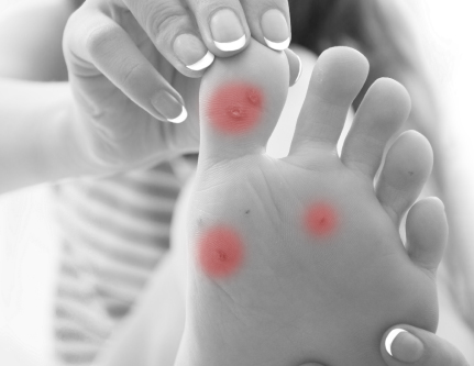 know-more-about-Paring-treatment-in-Delhi