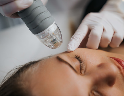 photo facial treatment