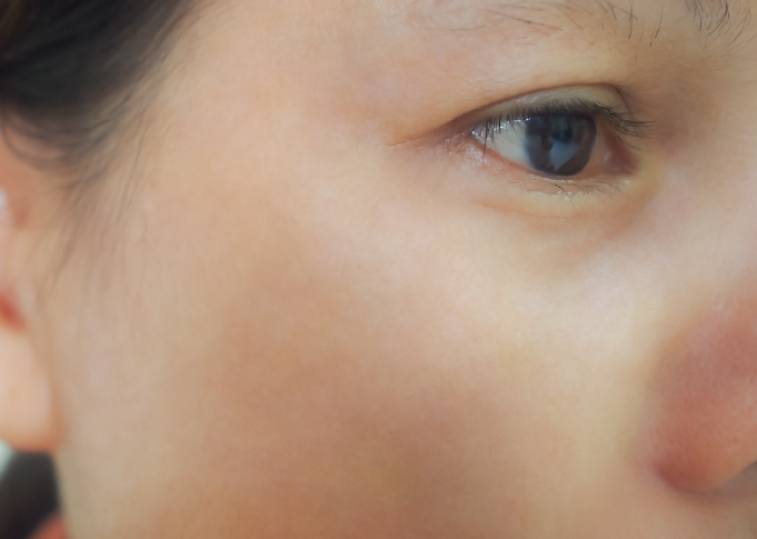 After treatment 2