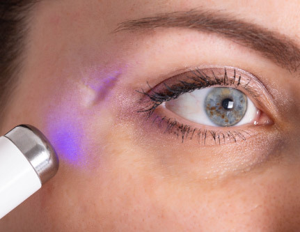 know-more-about-Scar Removal-treatment-in-Kochi