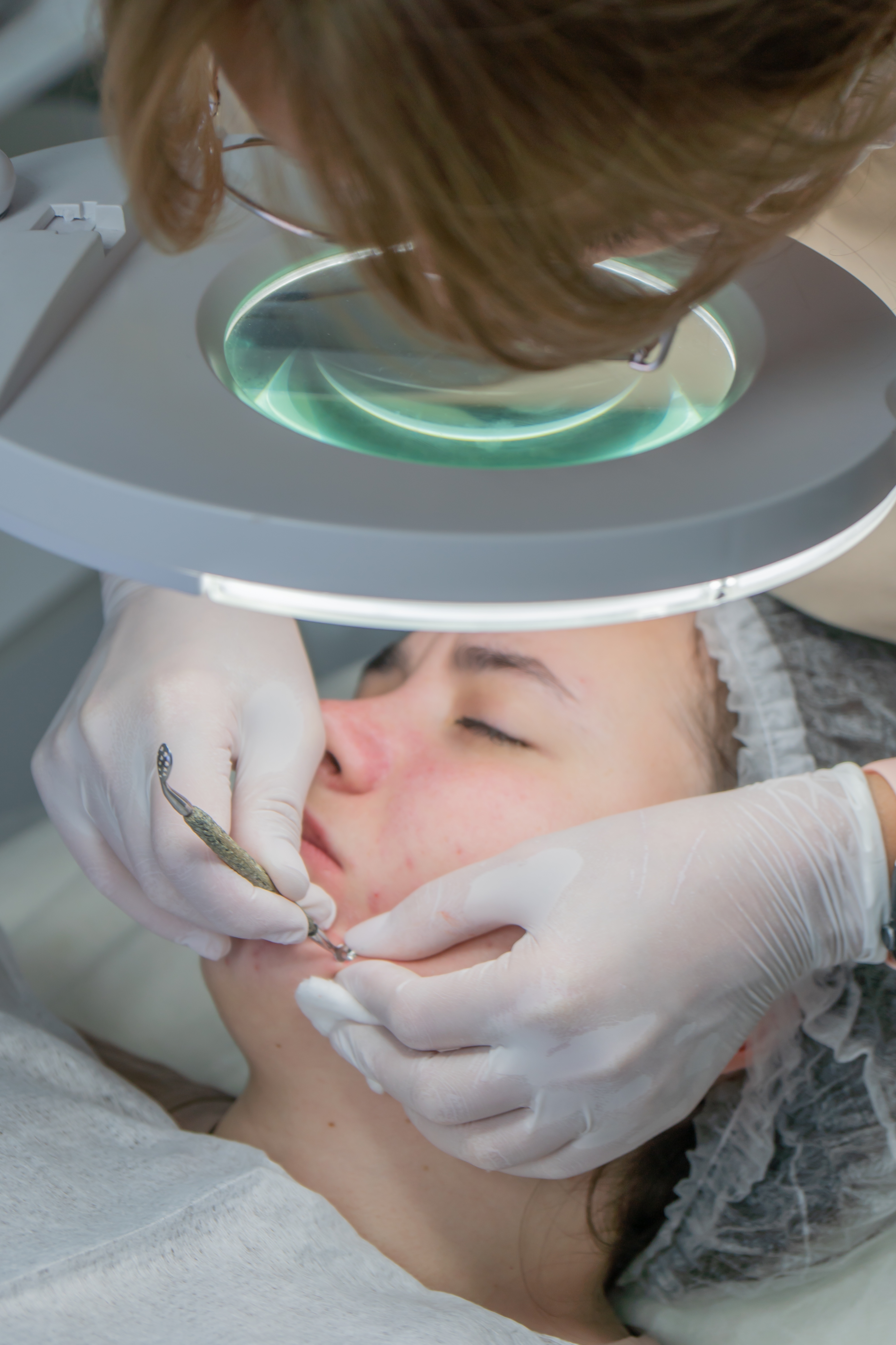 Overview of  Laser hair removal