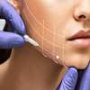 Skin Threadlift