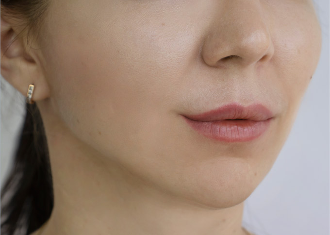 After treatment 1