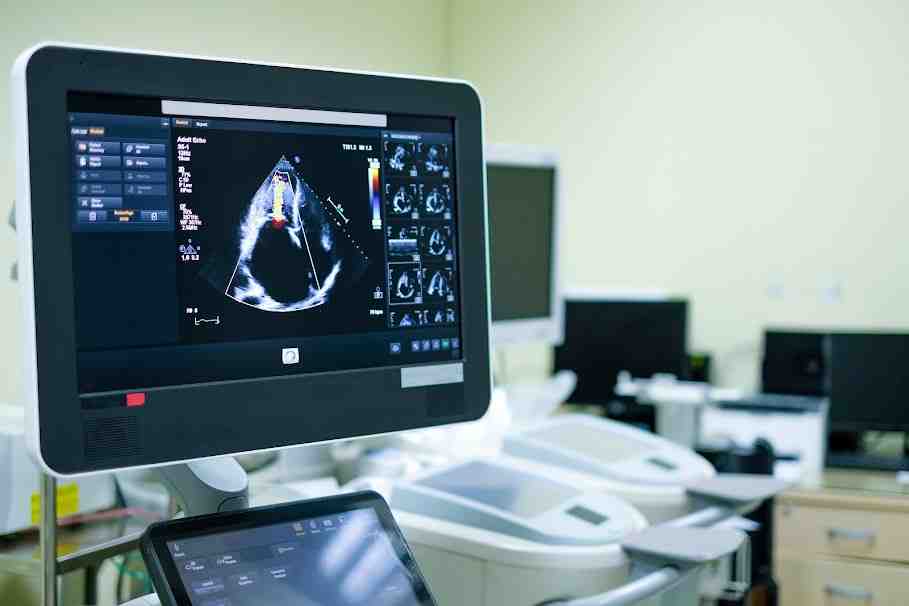 Pregnancy ultrasound