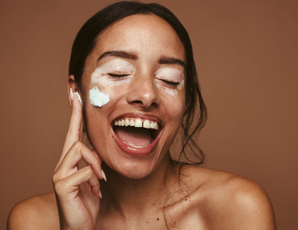 know-more-about-Vitiligo-treatment-in-Delhi
