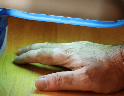 vitiligo treatment