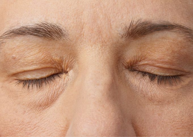 After treatment 1