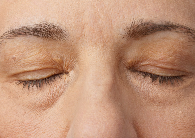 After treatment 1