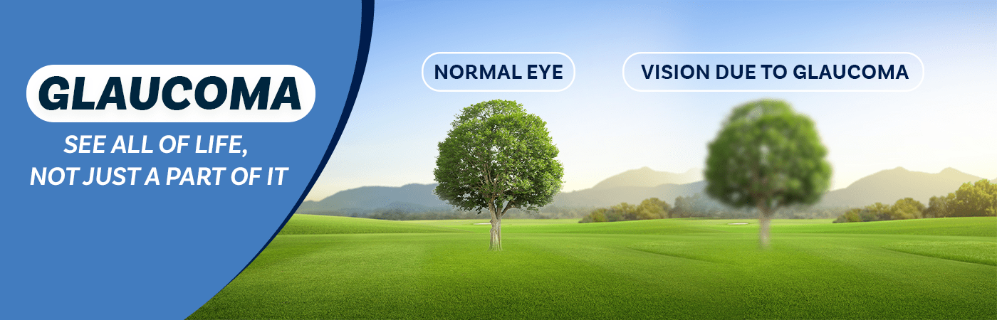 Glaucoma