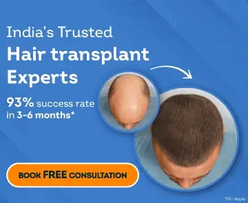 Expert HAIR Transplant