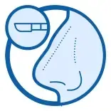 FESS Surgery
