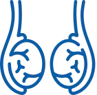 Hydrocele Surgery