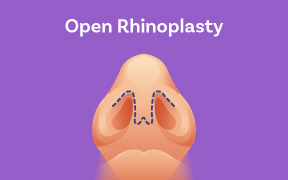 Rhinoplasty(Nose Reshaping Job) Surgery: Types, Benefits, and Recovery