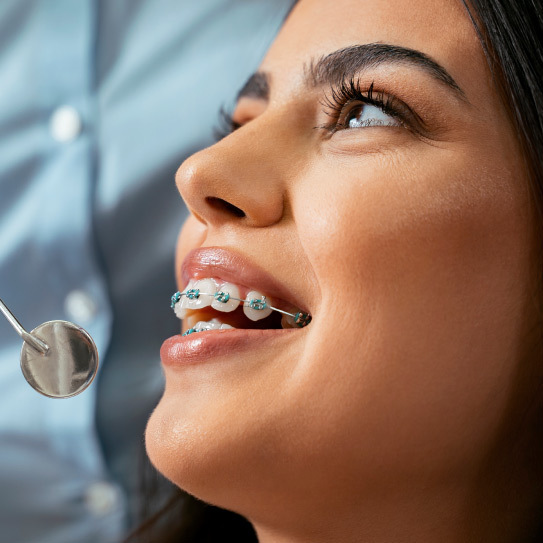 know-more-about-Dental Braces-treatment-in-Gurgaon