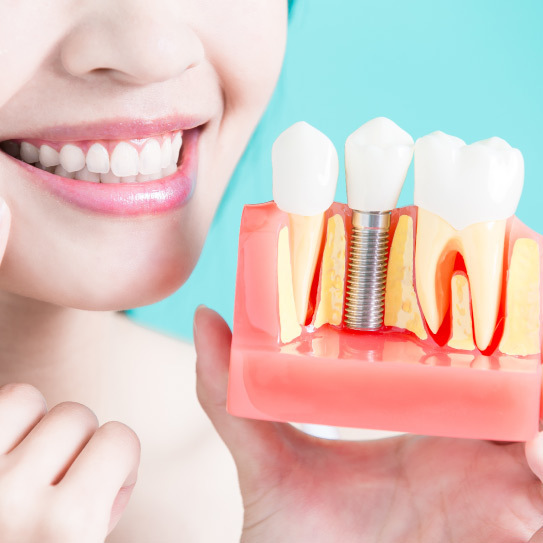 know-more-about-Dental Implants-treatment-in-Faridabad