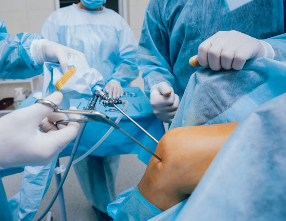 Doctor-performing-Arthroscopy-surgery-in-Bangalore